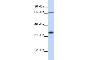 WB Suggested Anti-B3GALT1 Antibody Titration:  0. (B3GALT1 抗体  (C-Term))