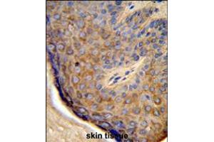 Formalin-fixed and paraffin-embedded human skin tissue reacted with TCHP Antibody , which was peroxidase-conjugated to the secondary antibody, followed by DAB staining. (TCHP 抗体  (AA 291-320))