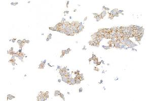 Immunocytochemistry (ICC) image for anti-Receptor tyrosine-protein kinase erbB-2 (ErbB2/Her2) (AA 1205-1255) antibody (ABIN7455181) (Recombinant ErbB2/Her2 抗体  (AA 1205-1255))