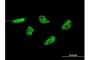 Immunofluorescence of monoclonal antibody to C17orf88 on HeLa cell. (FAM215A 抗体  (AA 28-114))