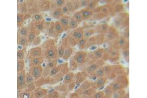 IHC-P analysis of Human Tissue, with DAB staining. (SULT1A1 抗体  (AA 2-295))