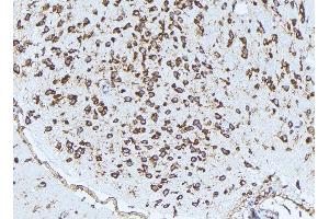 ABIN6272976 at 1/100 staining Rat brain tissue by IHC-P. (PSAT1 抗体  (Internal Region))