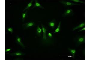 Immunofluorescence of monoclonal antibody to PKM2 on HeLa cell. (PKM2 抗体  (AA 436-531))