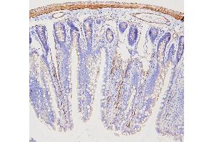 IHC analysis of FLNA using anti-FLNA antibody (ABIN7601782).