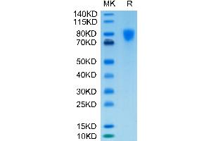 PDGFRA Protein (His-Avi Tag,Biotin)