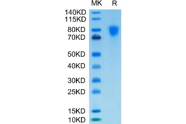 PDGFRA Protein (His-Avi Tag,Biotin)