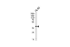Western Blotting (WB) image for anti-Haptoglobin Related Protein (HPR) (AA 212-240) antibody (ABIN655063)