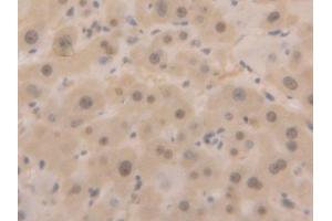 Used in DAB staining on fromalin fixed paraffin- embedded liver tissue (GAPDH 抗体  (AA 2-148))
