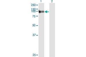 Western Blot analysis of FAP expression in transfected 293T cell line by FAP monoclonal antibody (M01), clone 1E5.