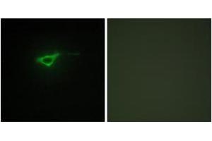Immunofluorescence (IF) image for anti-Collagen, Type XX, alpha 1 (COL20A1) (AA 1151-1200) antibody (ABIN1534360)