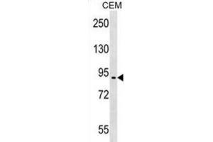Western Blotting (WB) image for anti-erythrocyte Membrane Protein Band 4.1 Like 4A (EPB41L4A) antibody (ABIN2999324) (EPB41L4A 抗体)