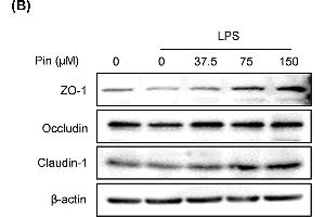 Pinocembrin increased the expression of tight junction proteins in vitro(A) Caco-2 cells were treated with different concentration of pinocembrin (0-150 μM) for 24 h, and then the mRNA expression of Occludin, Claudin-1 and JAM-A in Caco-2 cells were determined by qRT-PCR. (TJP1 抗体  (AA 1600-1700))