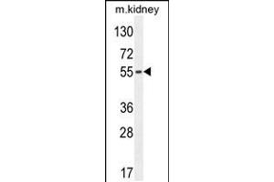 Western blot analysis in mouse kidney tissue lysates (35ug/lane). (FBXO39 抗体  (C-Term))