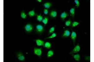 Immunofluorescence (IF) image for anti-SMAD, Mothers Against DPP Homolog 1 (SMAD1) (AA 202-335) antibody (ABIN7160224)