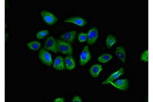 Immunofluorescent analysis of A549 cells using ABIN7145918 at dilution of 1:100 and Alexa Fluor 488-congugated AffiniPure Goat Anti-Rabbit IgG(H+L) (CCR1 抗体  (AA 314-362))