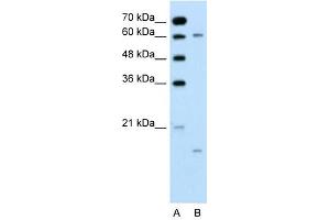 CYP4A22 antibody used at 0. (CYP4A22 抗体  (N-Term))