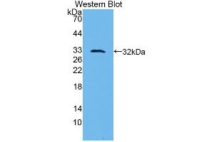 Western blot analysis of the recombinant protein. (PLAU 抗体  (AA 180-433))
