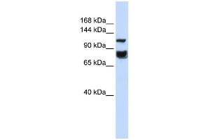 WB Suggested Anti-HDAC4 Antibody Titration:  0.