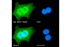 Immunofluorescence (IF) image for anti-Tripartite Motif Containing 8 (TRIM8) (C-Term) antibody (ABIN184949)
