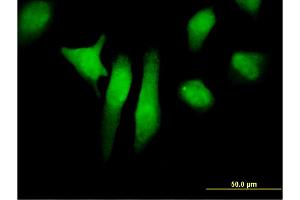 Immunofluorescence of monoclonal antibody to PTPN12 on HeLa cell. (PTPN12 抗体  (AA 682-779))