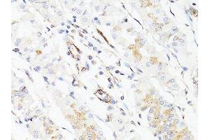 Immunohistochemistry of paraffin-embedded human stomach using VIM antibody. (Vimentin 抗体  (AA 1-101))