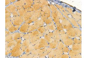 ABIN6257931 and ABIN6274147 at 1/100 staining Rat skin tissue by IHC-P.