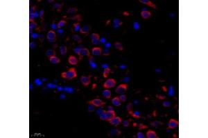 Immunofluorescence (Paraffin-embedded Sections) (IF (p)) image for anti-Protein Tyrosine Phosphatase G1 (PTPN12) antibody (ABIN7075292)
