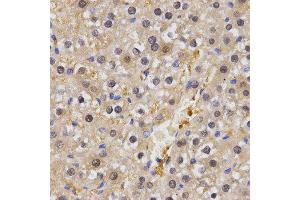 Immunohistochemistry (IHC) image for anti-Heat shock factor protein 2 (HSF2) antibody (ABIN3016593) (HSF2 抗体)