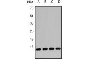 Western blot analysis of IFI6 expression in MCF7 (A), U251 (B), U937 (C), mouse pancreas (D) whole cell lysates. (IFI6 抗体)