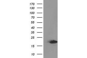 Western Blotting (WB) image for anti-Destrin (Actin Depolymerizing Factor) (DSTN) antibody (ABIN1497909) (Destrin 抗体)