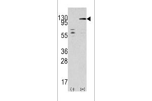 Western blot analysis of TAOK3 using rabbit polyclonal TAOK3 Antibody using 293 cell lysates (2 ug/lane) either nontransfected (Lane 1) or transiently transfected with the TAOK3 gene (Lane 2). (TAO Kinase 3 抗体  (C-Term))