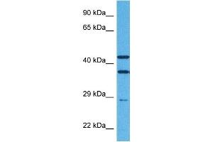 Host:  Rabbit  Target Name:  TREM2  Sample Tissue:  Human Jurkat Whole Cell  Antibody Dilution:  1ug/ml (TREM2 抗体  (Middle Region))