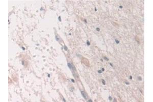 Immunohistochemistry (IHC) image for anti-USP6 N-terminal Like (USP6NL) (AA 1-292) antibody (ABIN7430093)