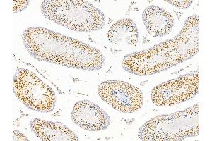 ABIN7094799 and ABIN7098850 at 1/100 staining Mouse testis tissue by IHC-P. (Forkhead Box K2 抗体  (C-Term))