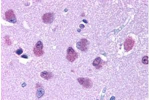 Human Brain (formalin-fixed, paraffin-embedded) stained with BRS3 antibody ABIN213383 at 10 ug/ml followed by biotinylated goat anti-rabbit IgG secondary antibody ABIN481713, alkaline phosphatase-streptavidin and chromogen. (BRS3 抗体  (Cytoplasmic Domain))