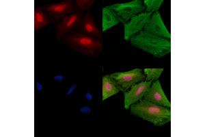 ABIN6257881 and ABIN6275326 staining  cells by IF/ICC.