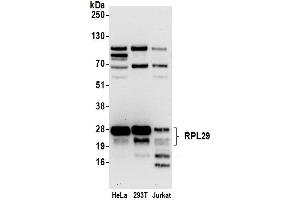 anti-Ribosomal Protein L29 (RPL29) (AA 109-159) antibody