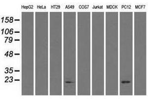 Image no. 2 for anti-Crystallin, alpha B (CRYAB) antibody (ABIN1497644) (CRYAB 抗体)