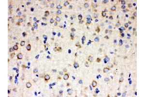 Anti- ULK3 Picoband antibody, IHC(P) IHC(P): Rat Brain Tissue (ULK3 抗体  (C-Term))