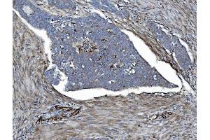 IHC analysis of EHD3 using anti-EHD3 antibody (ABIN7602777). (EHD3 抗体  (C-Term))