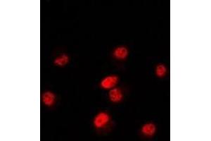 Immunofluorescent analysis of POLR3E staining in Hela cells. (POLR3E 抗体)