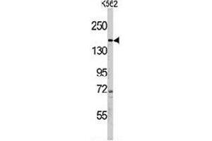 Western blot analysis of PHLPP1 polyclonal antibody  in K-562 cell line lysates (35 ug/lane). (PHLPP1 抗体  (N-Term))