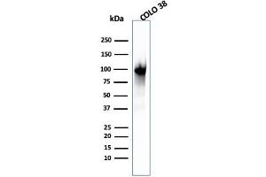 Western Blot Analysis of COLO-38 cell lysate using gp100 Mouse Monoclonal Antibody (PMEL/2039). (Melanoma gp100 抗体  (AA 376-502))