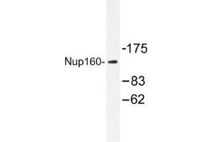 Image no. 1 for anti-Nucleoporin 160kDa (NUP160) antibody (ABIN317926) (NUP160 抗体)