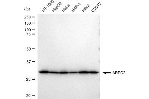 Western blotting analysis using ARPC2 antibody (ABIN7797453).