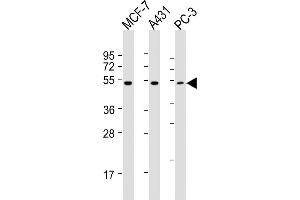 All lanes : Anti-P2R5E Antibody (C-term) at 1:2000 dilution Lane 1: MCF-7 whole cell lysates Lane 2: A431 whole cell lysates Lane 3: PC-3 whole cell lysates Lysates/proteins at 20 μg per lane. (PPP2R5E 抗体  (C-Term))