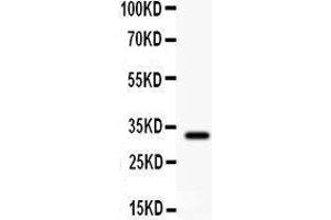 Anti- GST3/GST pi Picoband antibody, Western blotting All lanes: Anti GST3/GST pi at 0. (GSTP1 抗体  (AA 2-210))