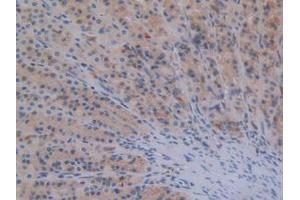 IHC-P analysis of Rat Stomach Tissue, with DAB staining. (STAT2 抗体  (AA 587-838))