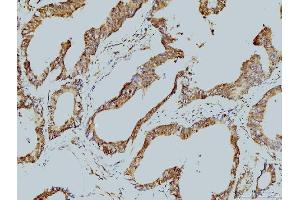 IHC analysis of LSM8 using anti-LSM8 antibody (ABIN7599578). (NAA38 抗体  (AA 1-96))