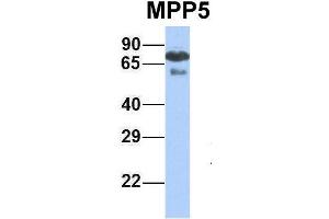 Host:  Rabbit  Target Name:  MPP5  Sample Type:  Human Fetal Lung  Antibody Dilution:  1. (MPP5 抗体  (N-Term))